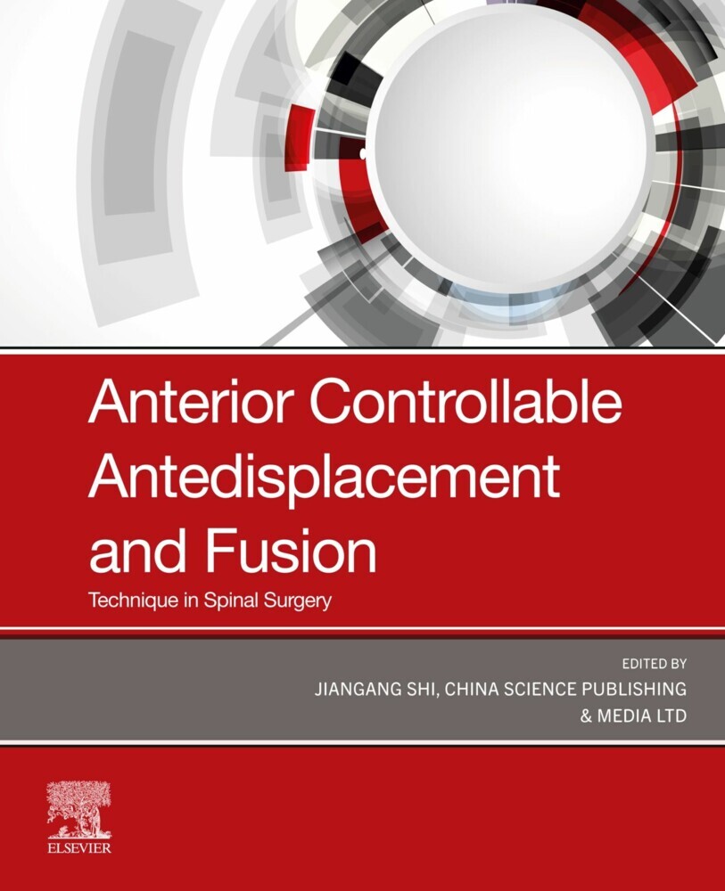 Anterior Controllable Antedisplacement and Fusion (ACAF) main product photo
