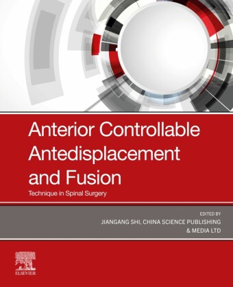Anterior Controllable Antedisplacement and Fusion (ACAF)