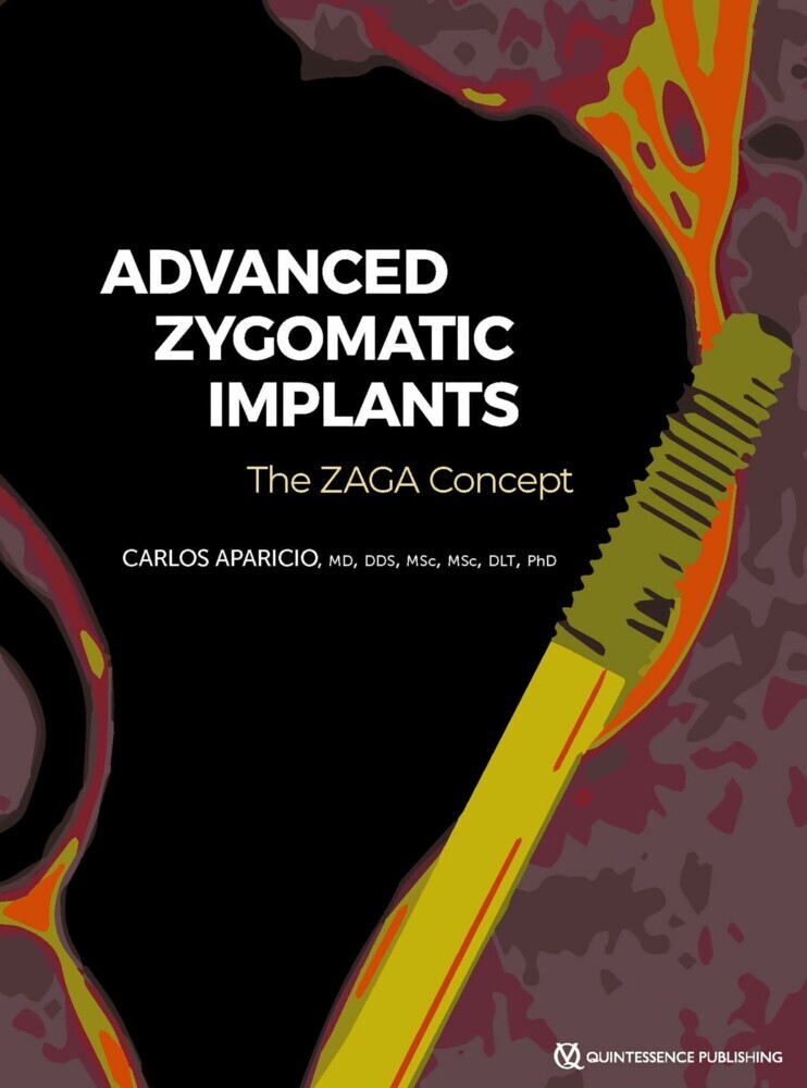 Advanced Zygomatic Implants main product photo