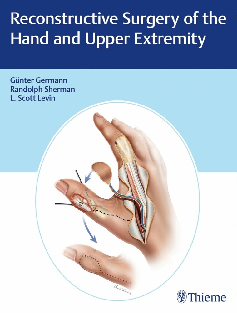 Reconstructive Surgery of the Hand and Upper Extremity main product photo