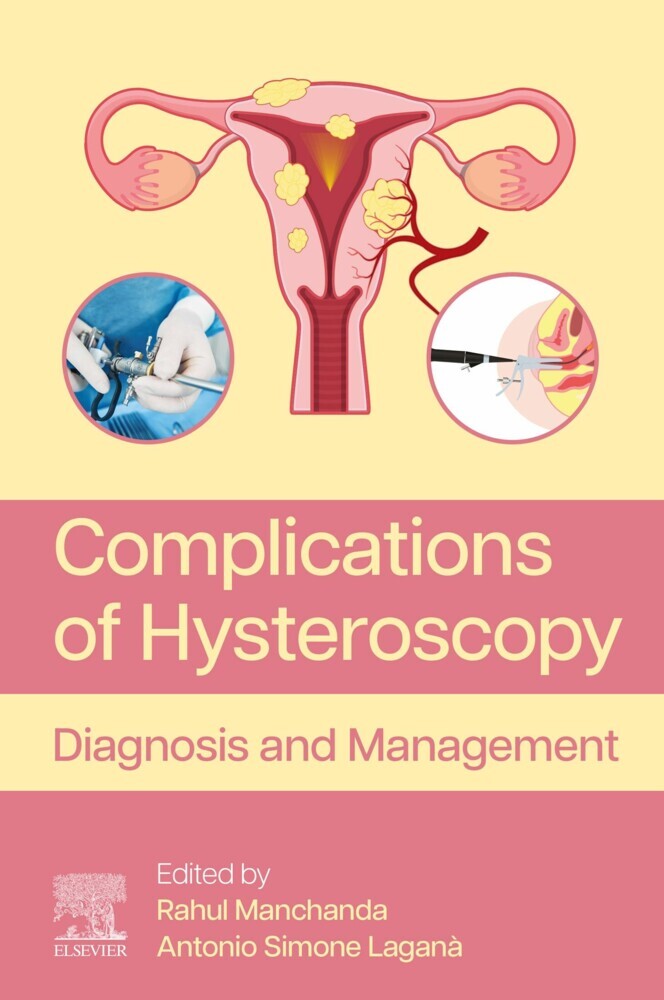 Complications of Hysteroscopy main product photo