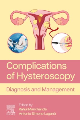 Complications of Hysteroscopy
