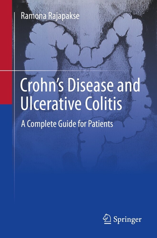 Crohn's Disease and Ulcerative Colitis main product photo