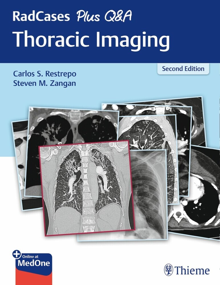 RadCases Plus Q&A Thoracic Imaging main product photo