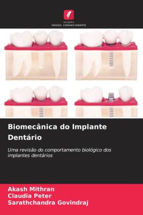 Biomecânica do Implante Dentário