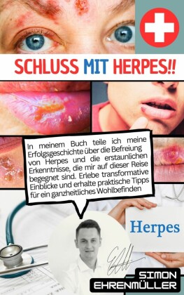 Schluss mit Herpes