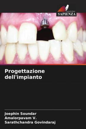 Progettazione dell'impianto