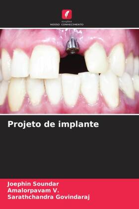 Projeto de implante