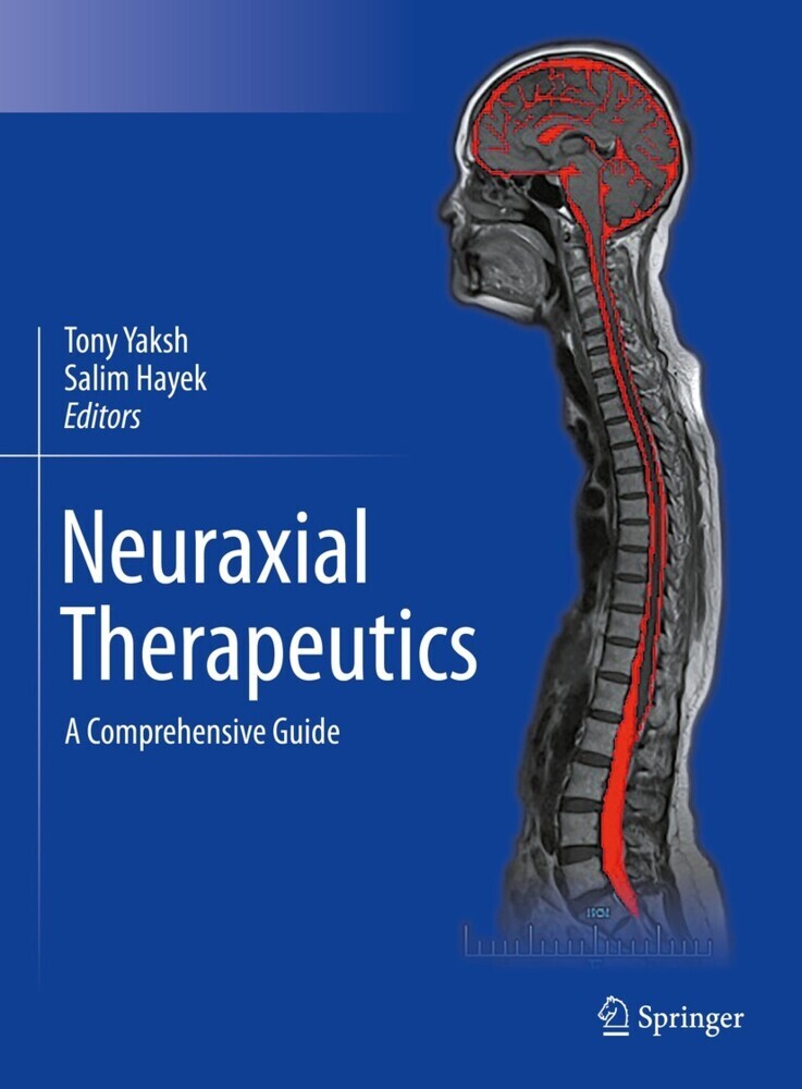 Neuraxial Therapeutics main product photo