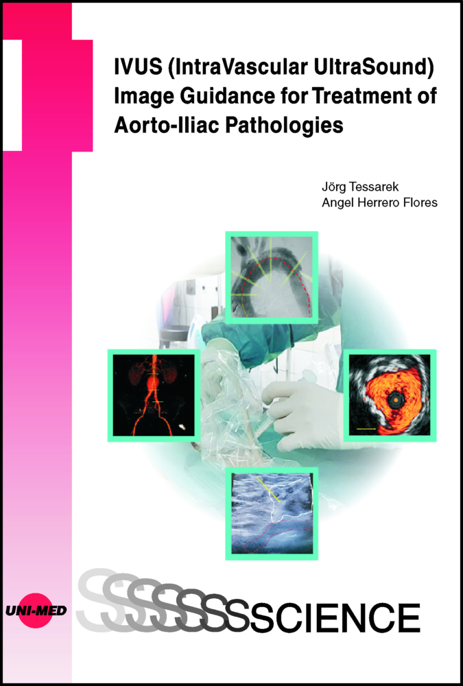 IVUS (IntraVascular UltraSound) Image Guidance for Treatment of Aorto-Iliac Pathologies main product photo