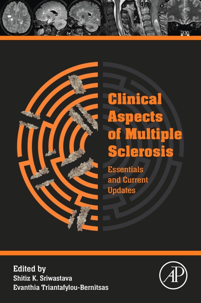 Clinical Aspects of Multiple Sclerosis Essentials and Current Updates main product photo