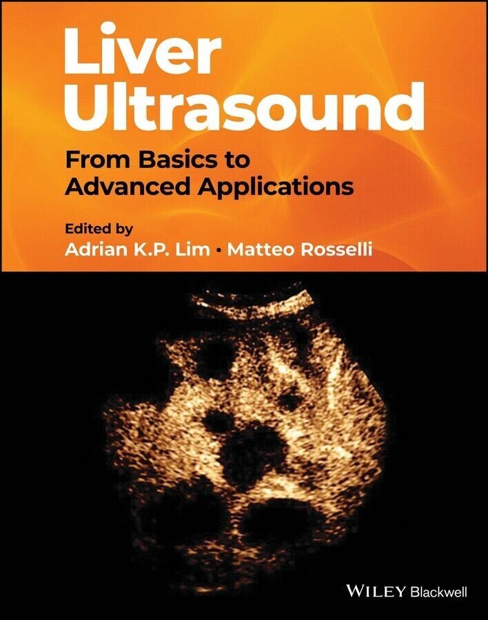 Liver Ultrasound main product photo