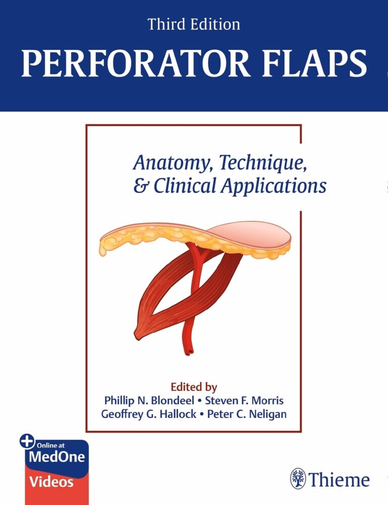 Perforator Flaps main product photo