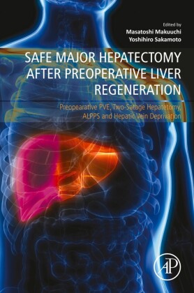 Safe Major Hepatectomy after Preoperative Liver Regeneration