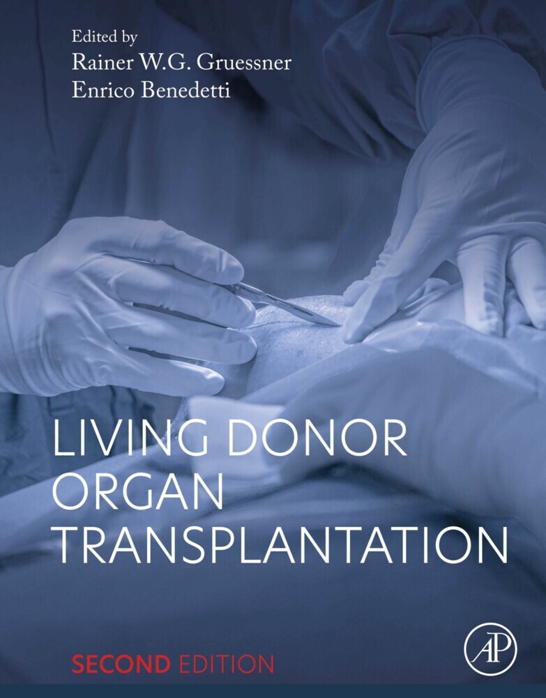 Living Donor Organ Transplantation main product photo