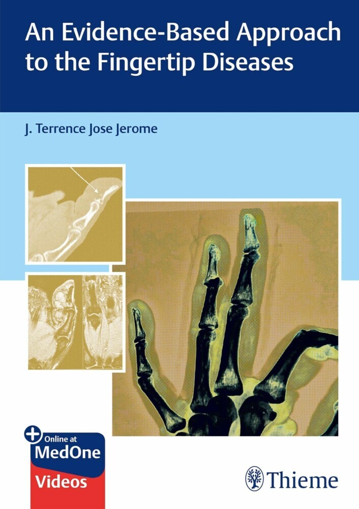 An Evidence-Based Approach to the Fingertip Diseases main product photo