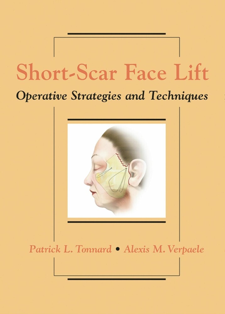 Short-Scar Face Lift main product photo