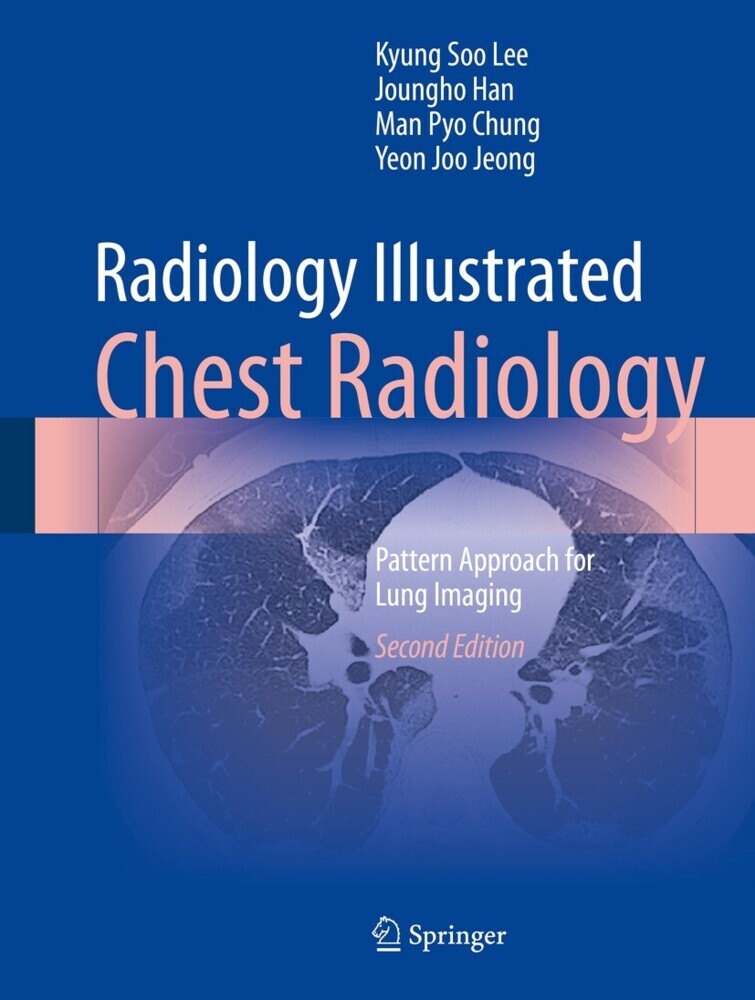 Radiology Illustrated: Chest Radiology main product photo