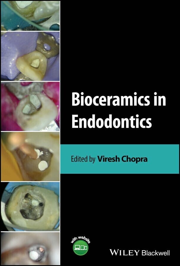 Bioceramics in Endodontics main product photo