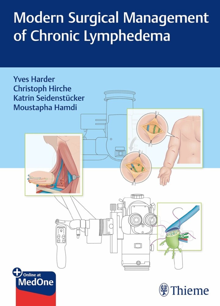 Modern Surgical Management of Chronic Lymphedema main product photo