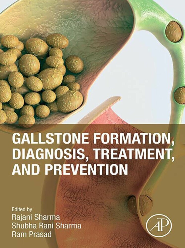 Gallstone Formation, Diagnosis, Treatment and Prevention main product photo