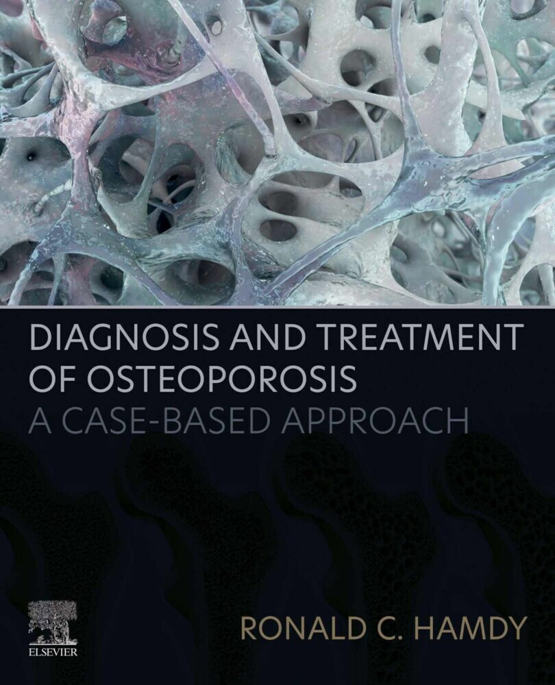 Diagnosis and Treatment of Osteoporosis main product photo