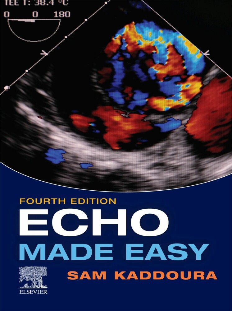 Echo Made Easy , E-Book main product photo