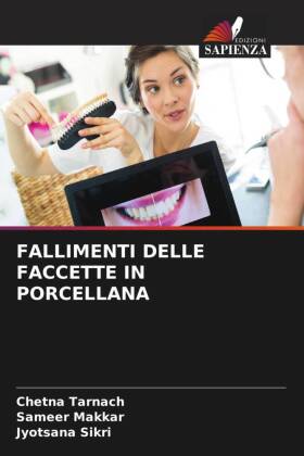 FALLIMENTI DELLE FACCETTE IN PORCELLANA 