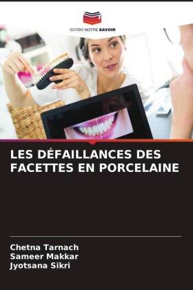 LES DÉFAILLANCES DES FACETTES EN PORCELAINE