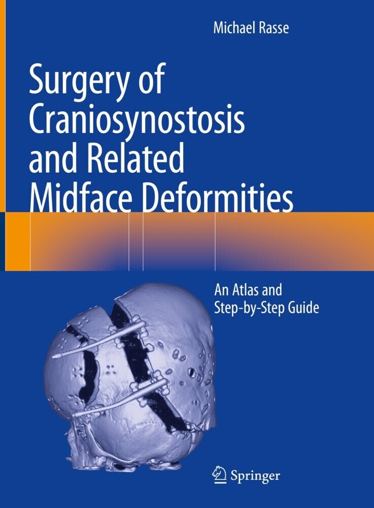 Surgery of Craniosynostosis and Related Midface Deformities main product photo