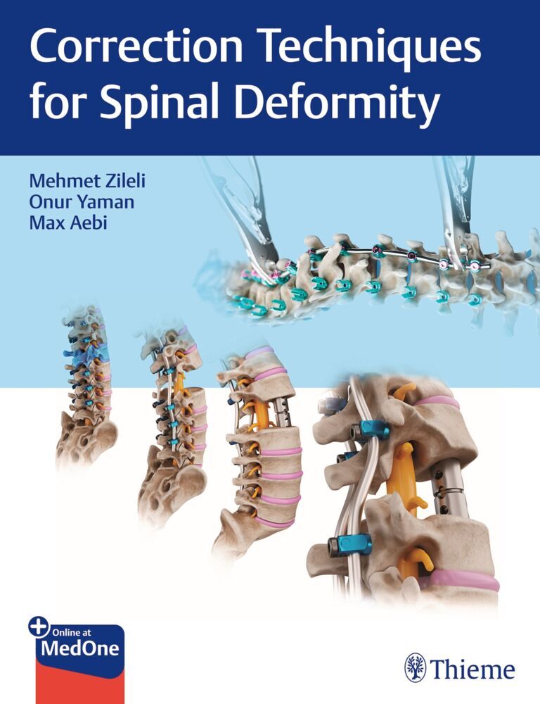 Correction Techniques for Spinal Deformity main product photo