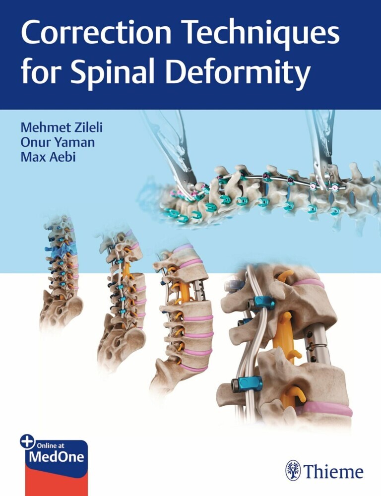 Correction Techniques for Spinal Deformity main product photo