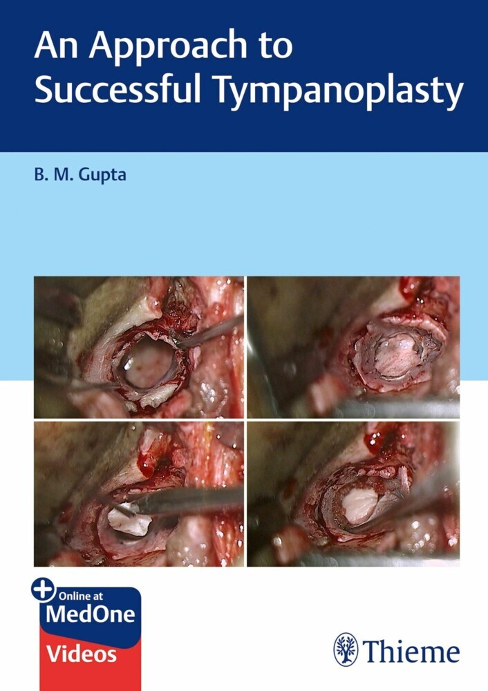 An Approach to Successful Tympanoplasty main product photo