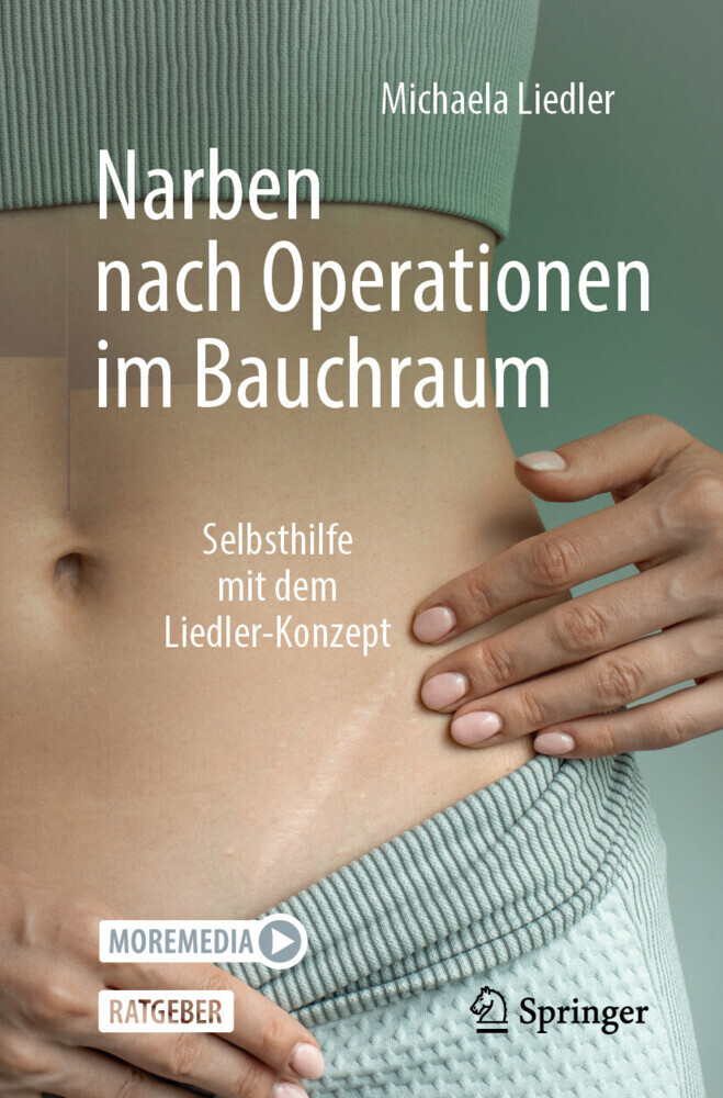 Narben nach Operationen im Bauchraum main product photo