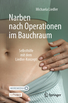 Narben nach Operationen im Bauchraum