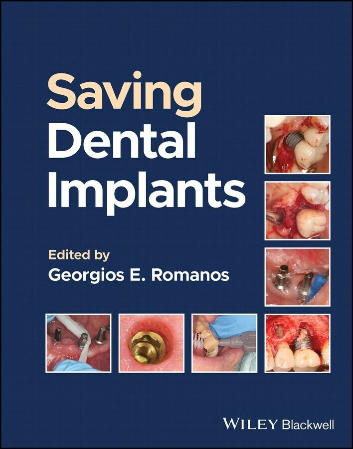 Saving Dental Implants main product photo