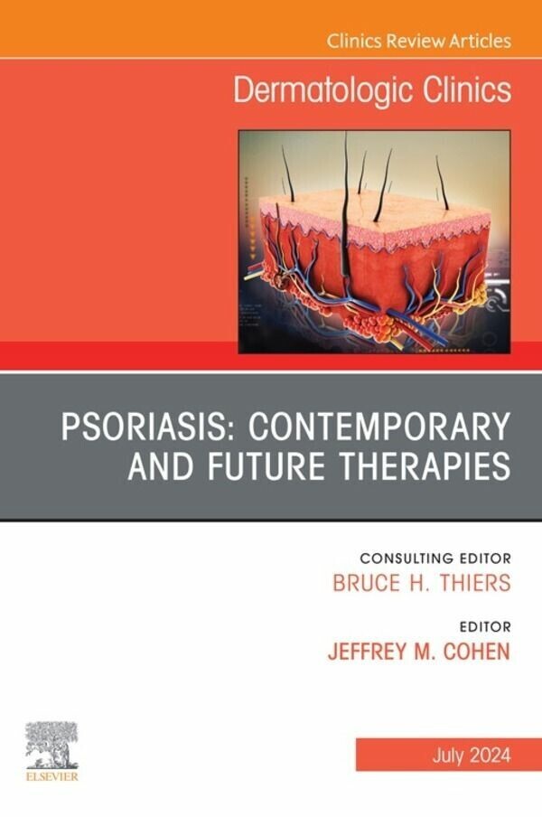 Psoriasis: Contemporary and Future Therapies, An Issue of Dermatologic Clinics, E-Book main product photo