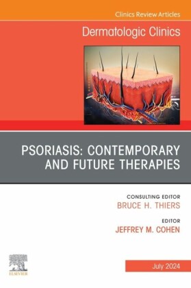 Psoriasis: Contemporary and Future Therapies, An Issue of Dermatologic Clinics, E-Book