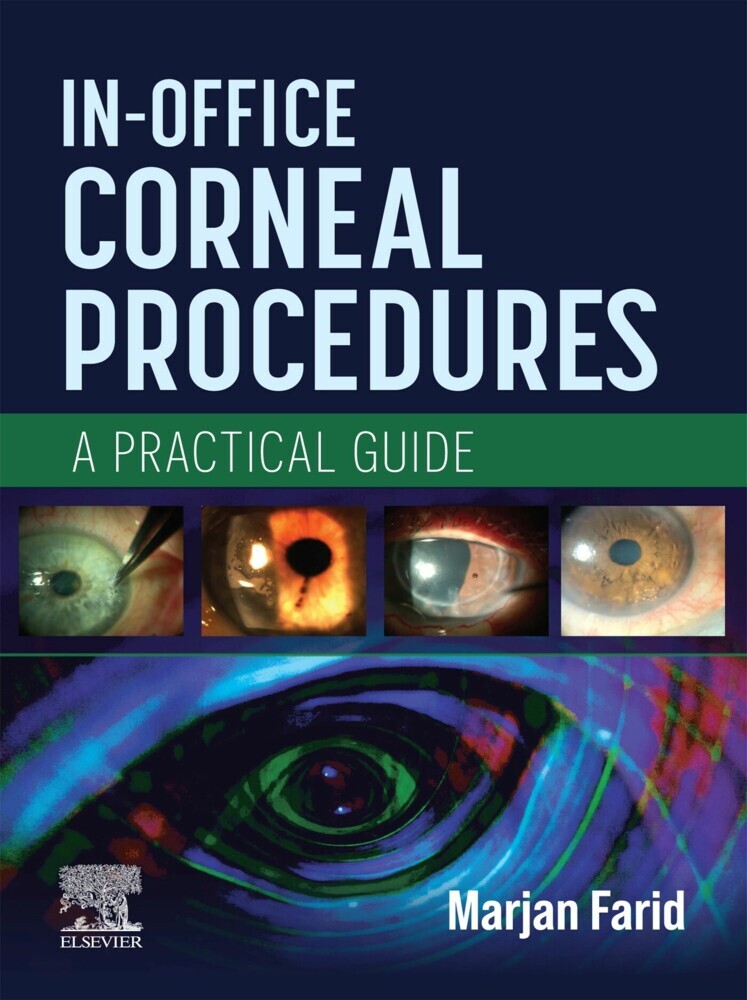 In-Office Corneal Procedures - E-BOOK main product photo
