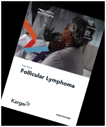 Fast Facts: Follicular Lymphoma