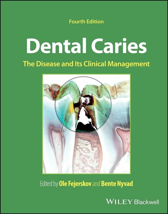 Dental Caries main product photo