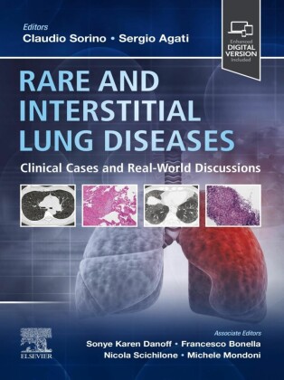 Rare and Interstitial Lung Diseases