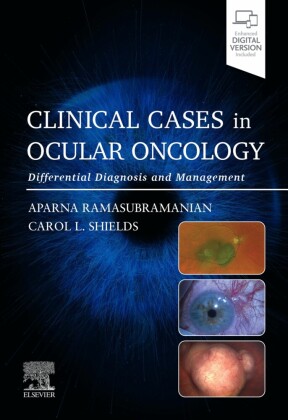 Clinical Cases in Ocular Oncology - E-BOOK