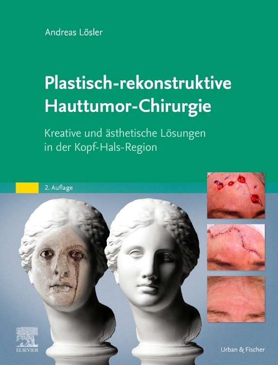 Plastisch-rekonstruktive Hauttumor-Chirurgie main product photo