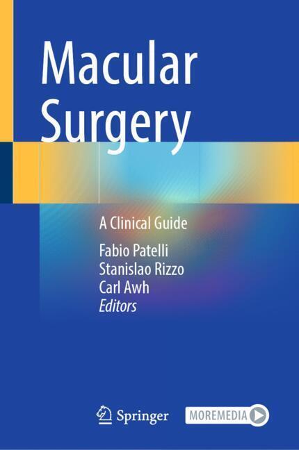Macular Surgery main product photo