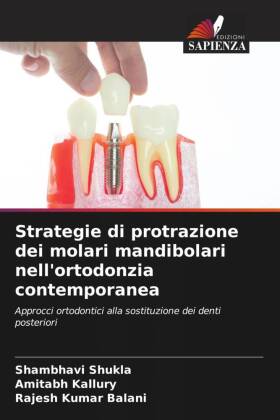 Strategie di protrazione dei molari mandibolari nell'orto...