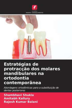 Estratégias de protracção dos molares mandibulares na ortod...