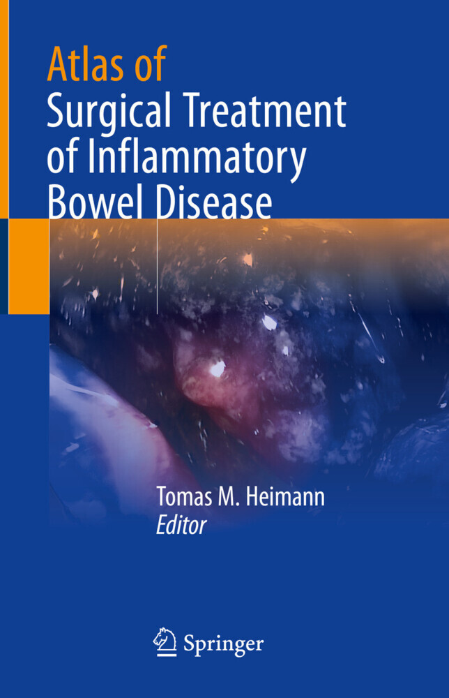 Atlas of Surgical Treatment of Inflammatory Bowel Disease main product photo