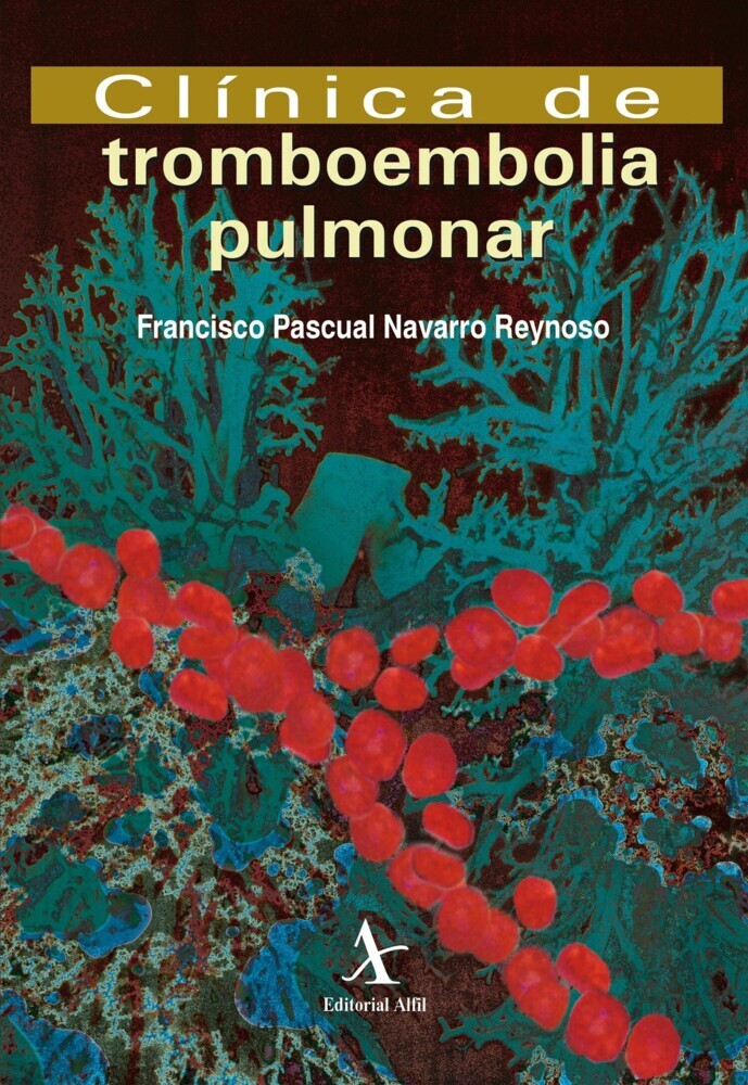 Clínica de tromboembolia pulmonar main product photo