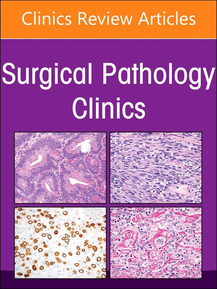Endocrine Pathology, An Issue of Surgical Pathology Clinics, E-Book main product photo